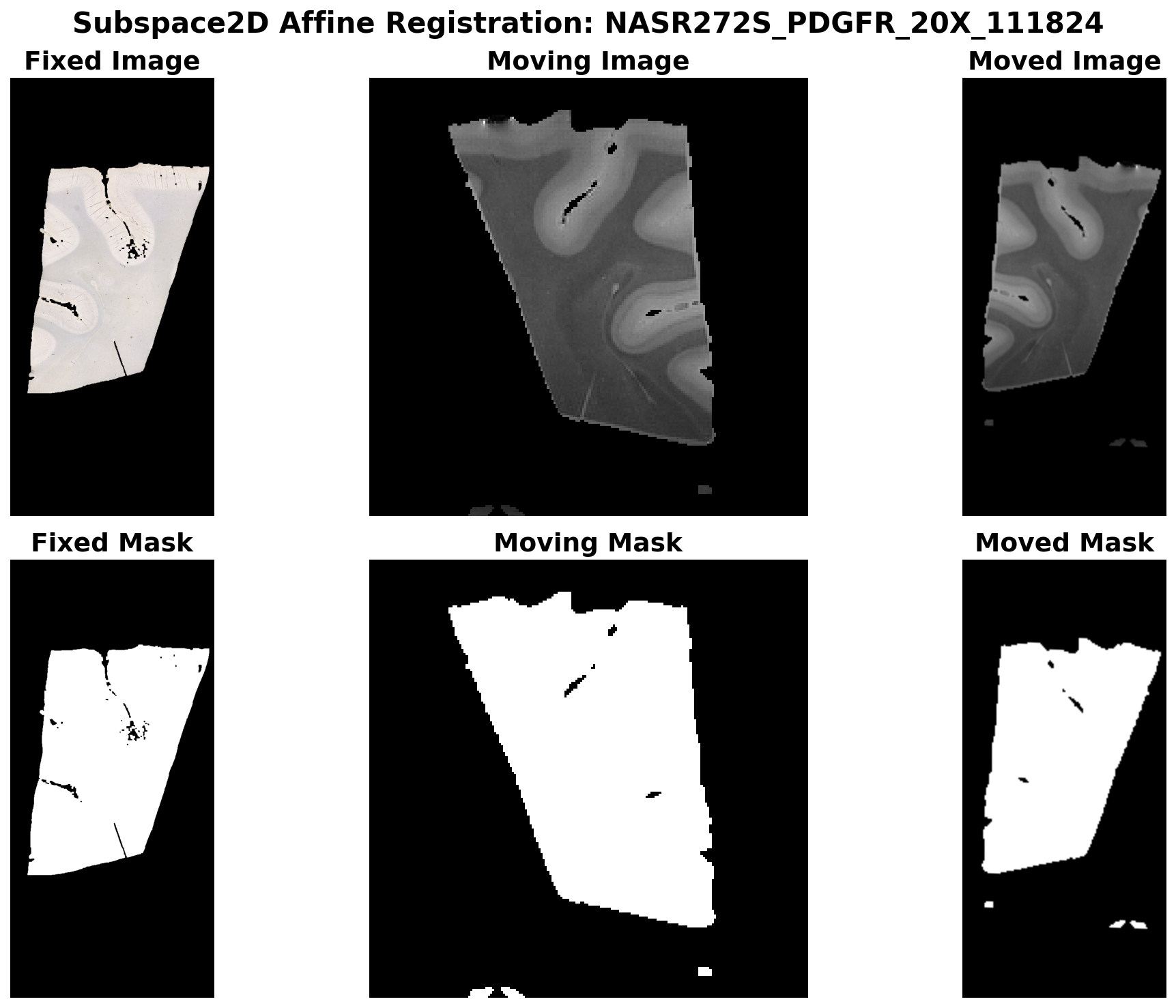 Subspace2D Affine Registration - PDGFR stain
