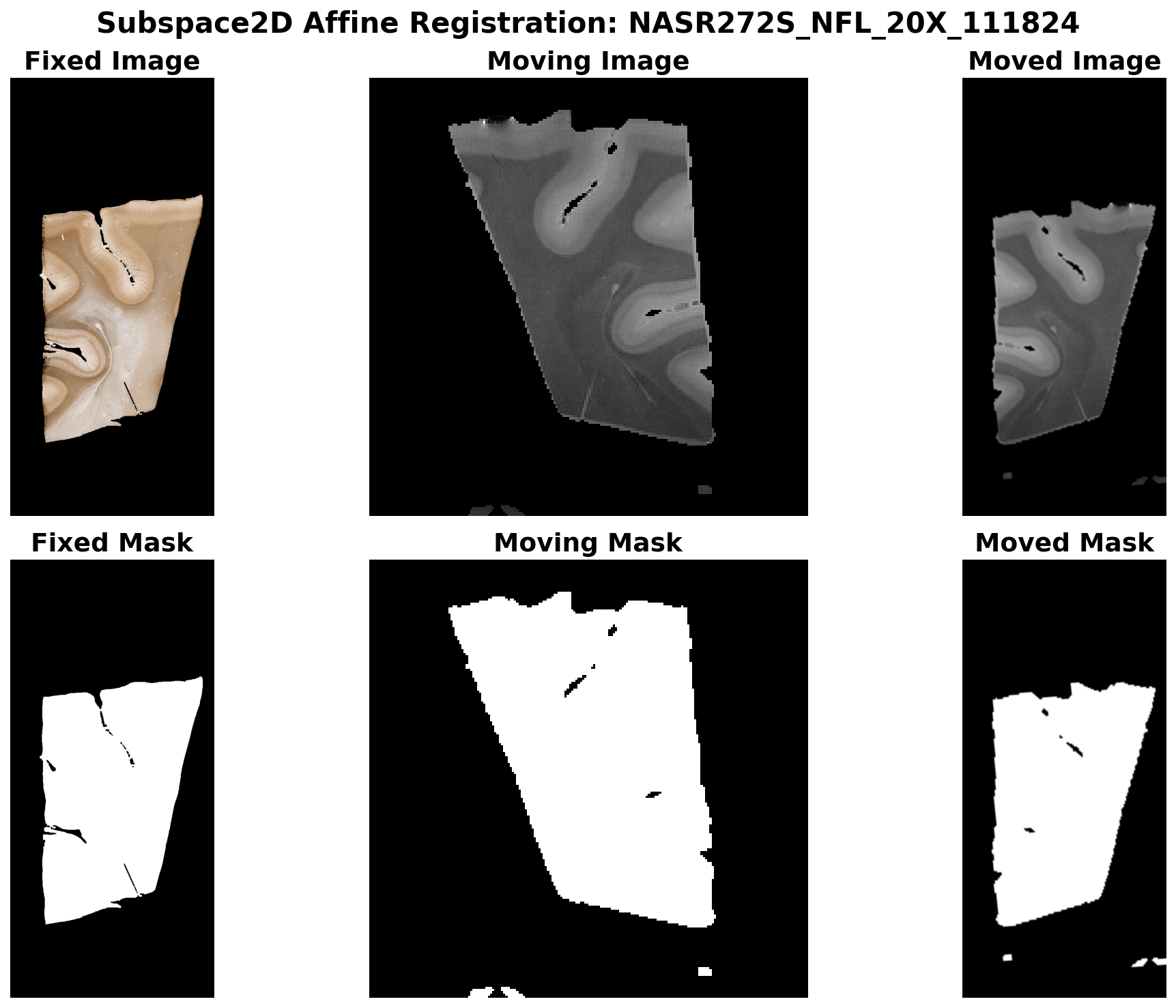 Subspace2D Affine Registration - NFL stain