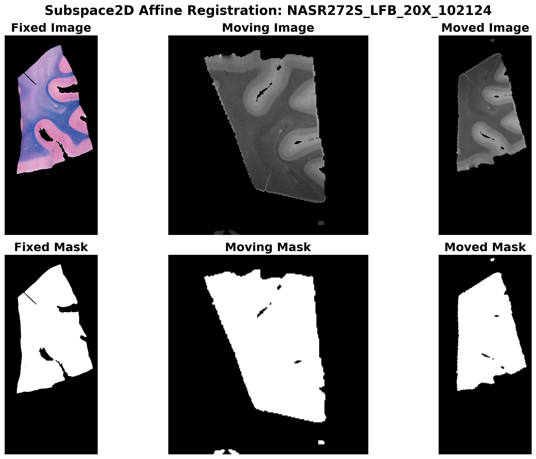 Subspace2D Affine Registration - MBP stain
