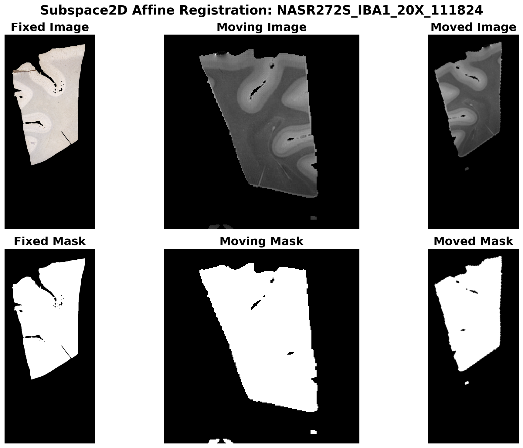 Subspace2D Affine Registration - SMA stain